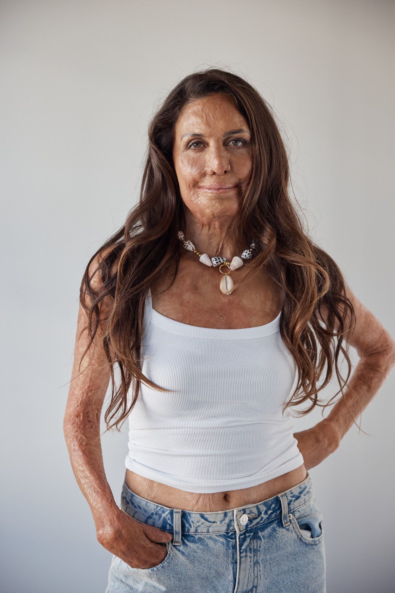 Turia Pitt
